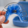 Aparelho Azul com Expansor Metálico